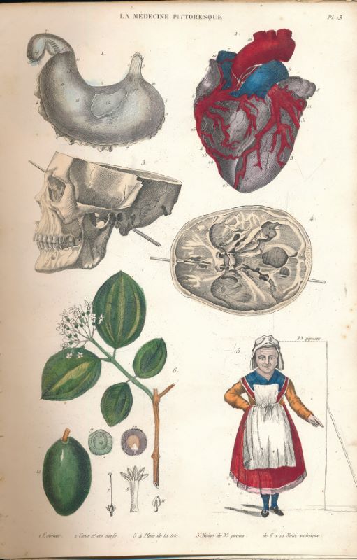 La médecine pittoresque. Recueil de 91 planches couleurs