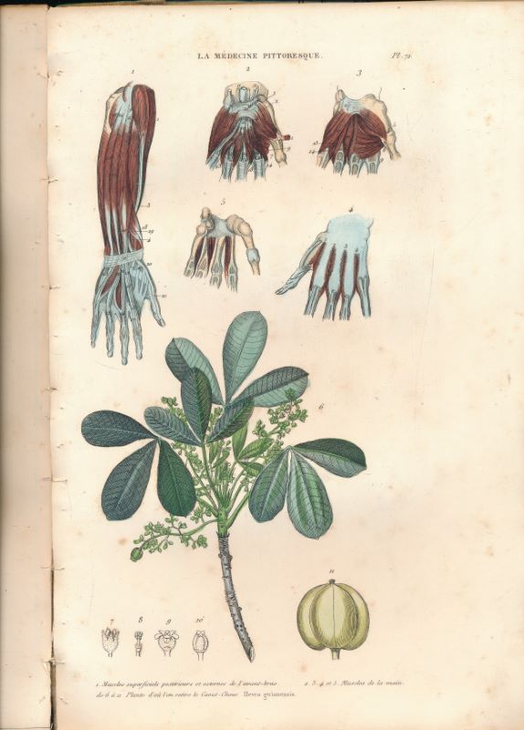 La médecine pittoresque. Recueil de 91 planches couleurs